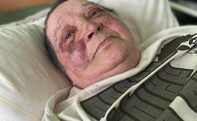 70-year-old journalist from Kherson had her spine broken by occupants