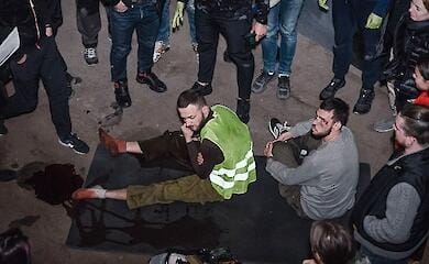 russian embassy in London accuses Ukraine of creating fake photos of wounded civilians