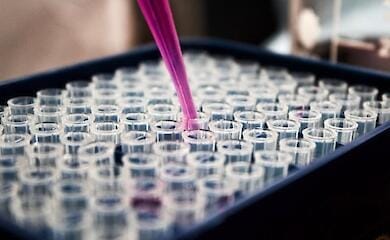 Hepatitis A outbreak reported in the occupied territories