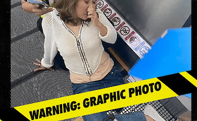 Auf einem Flughafen in Thailand hat ein Förderband das Bein einer Frau zerkaut. Sanitäter führten vor Ort eine Amputation durch