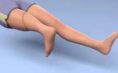 A rare rotational plastic surgery was performed in Lviv