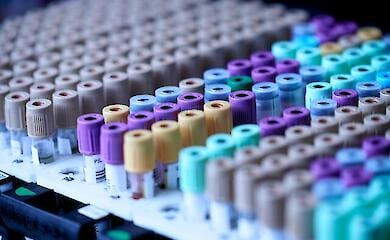 PRC warns of risk of new pandemic
