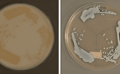 Candida auris