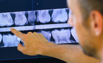 Forscher finden heraus, wie die Mundgesundheit mit Migräne bei Frauen zusammenhängt
