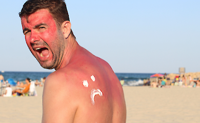 When tanning is dangerous: what you need to know about sunburn and how to avoid skin cancer