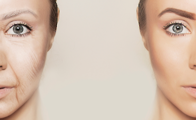 New remedies against "face after weight loss": how to keep skin youthful while taking GLP-1 drugs