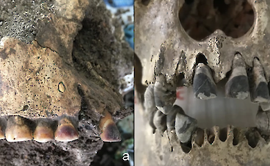 Wissenschaftler haben die fr&uuml;hesten Spuren der vietnamesischen Tradition des "Schw&auml;rzens" der Z&auml;hne gefunden - sie ist etwa 2000 Jahre alt