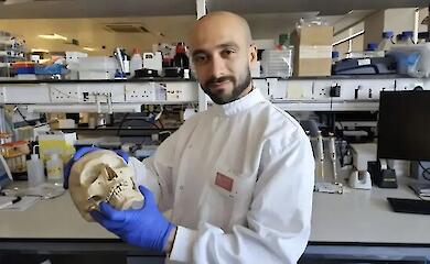Wolle kann helfen, Knochen zu reparieren - Studie