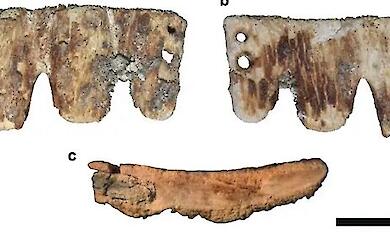 Archaeologists have found an ancient dental bridge made of animal bone in Porto